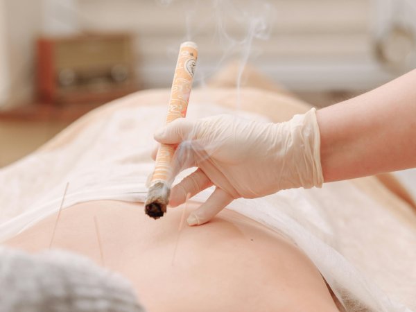TCM moxibustion treatment